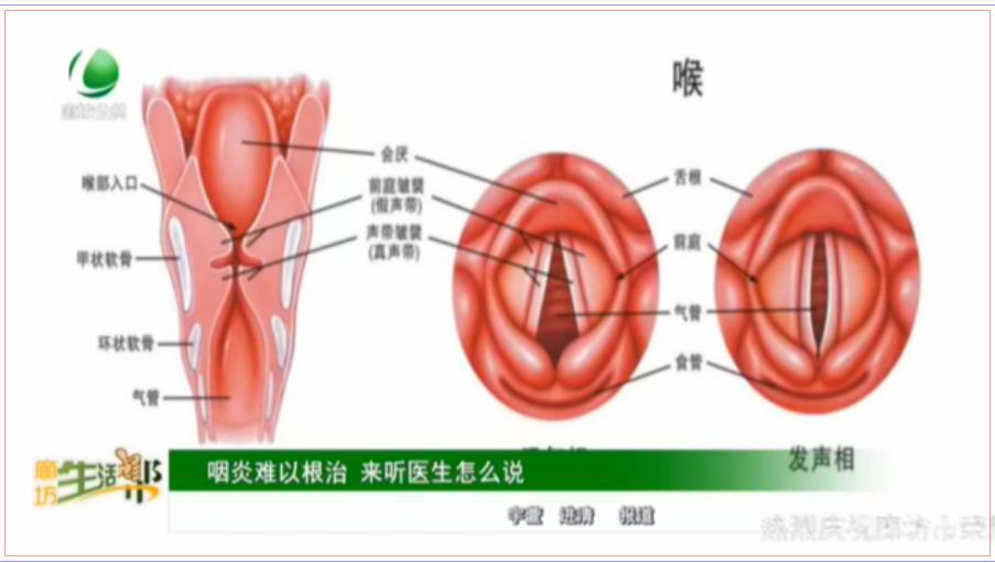 咽炎難以根治 來(lái)聽(tīng)醫(yī)生怎么說(shuō)